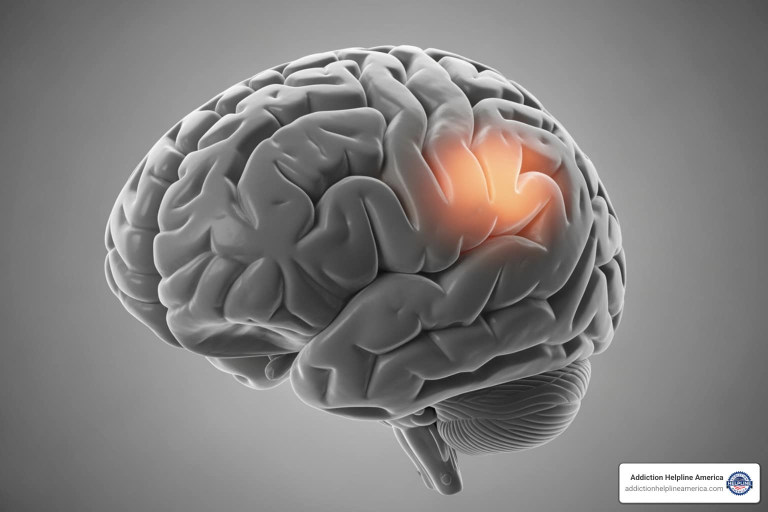 image of brain showing areas affected by marijuana use - Marijuana Treatment